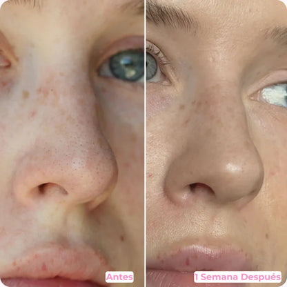 Espátula Facial Ultrasónica SonicGlow™ Inalámbrico 3 en 1🔋
